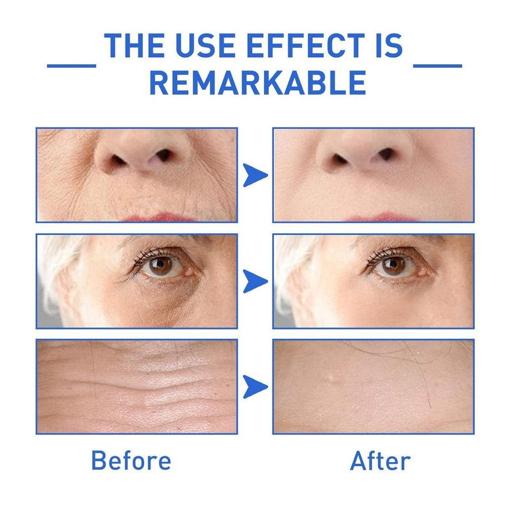 Botox Anti-Aging Serum, Youthfully Botox Face Serum(Pack Of 1)